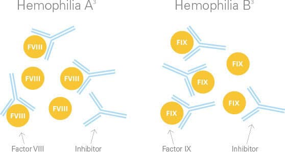 People with hemophilia A or B can develop inhibitors, which prevent their factor VIII or IX treatment from working to form a clot to stop bleeding