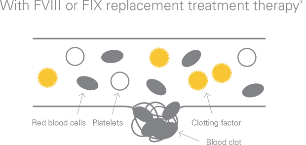 With factor VIII or IX replacement therapy the clotting mechanism can be restored in people with hemophilia A or B respectively.